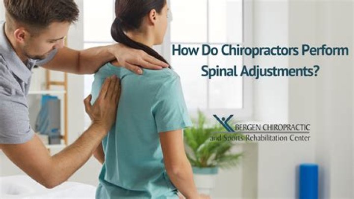 Do chiropractors sell supplements?